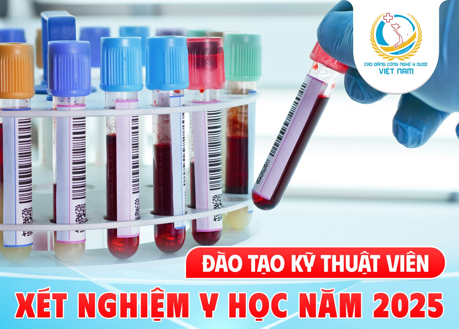 Điểm xét tuyển Ngành Cao đẳng Kỹ thuật Xét nghiệm Y học Cần Thơ 2025